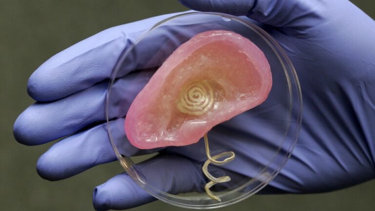 Bionic ear created by princeton researchers